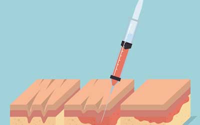 Botox 2D Image