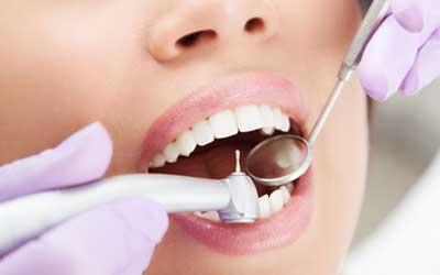 Teeth Cleaning